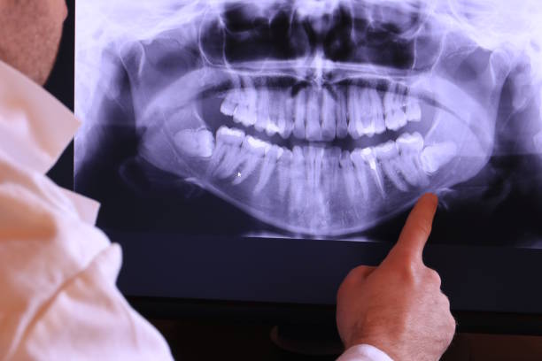 Best Emergency Dentist for Knocked-Out Tooth in Spirit Lake, IA