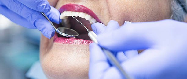 Best Emergency Dentist for Knocked-Out Tooth in Spirit Lake, IA